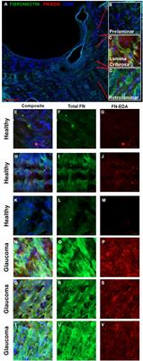 TLR4 signaling modulates extracellular matrix production in the lamina cribrosa